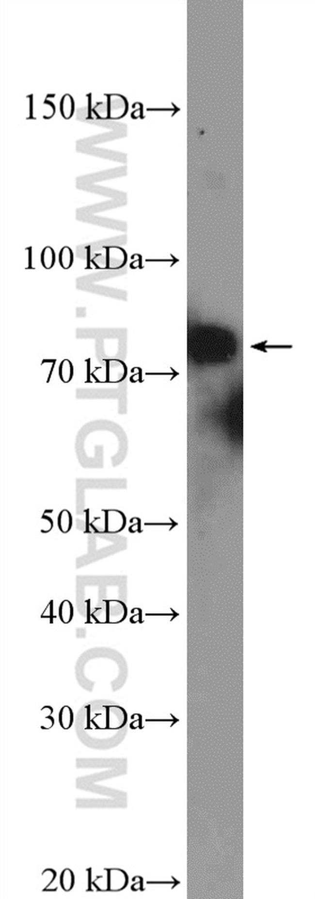 XRCC1 Antibody in Western Blot (WB)