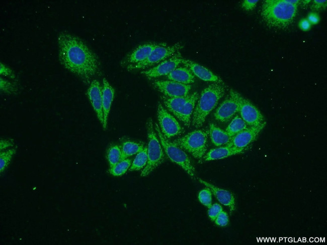 VANGL2 Antibody in Immunocytochemistry (ICC/IF)