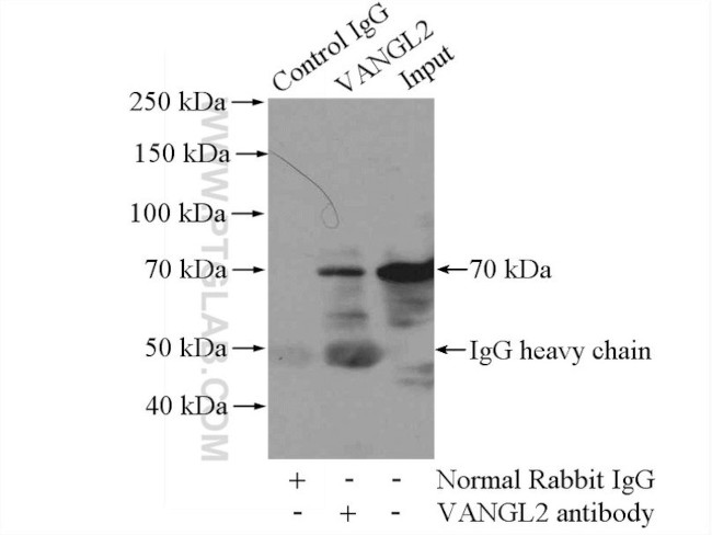 VANGL2 Antibody in Immunoprecipitation (IP)
