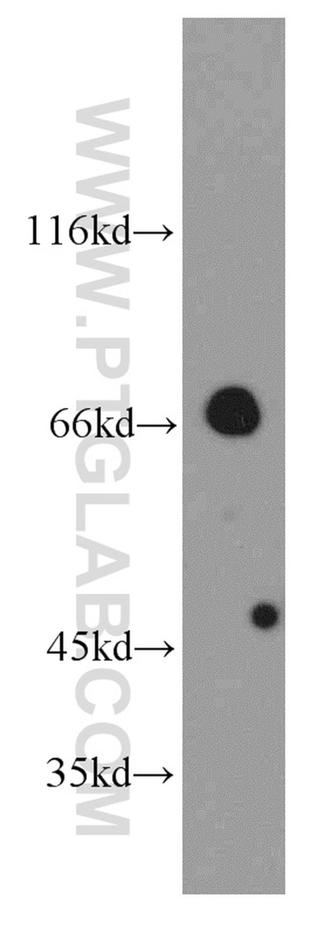 Arp5/ACTR5 Antibody in Western Blot (WB)