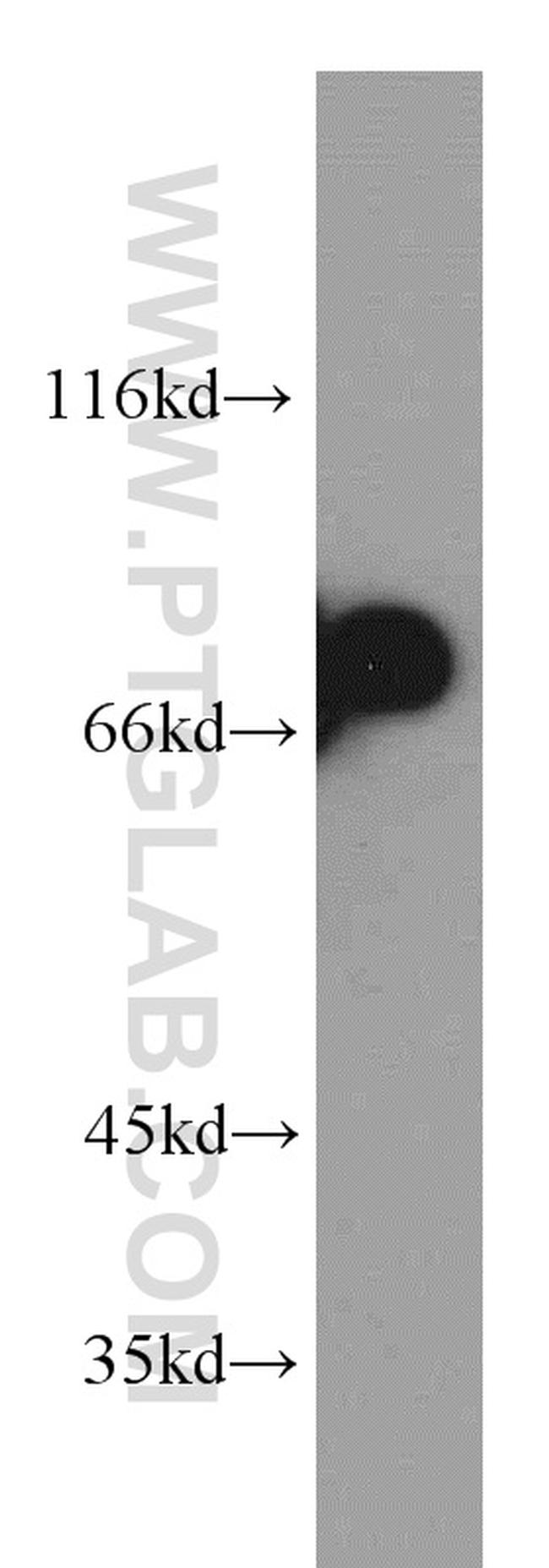 Arp5/ACTR5 Antibody in Western Blot (WB)
