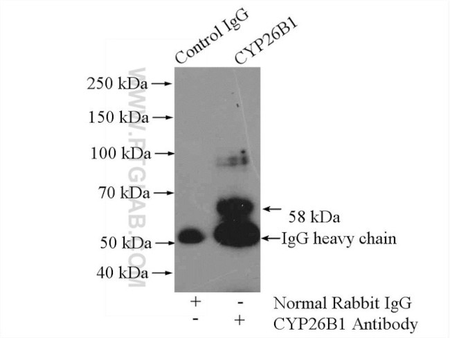 CYP26B1 Antibody in Immunoprecipitation (IP)
