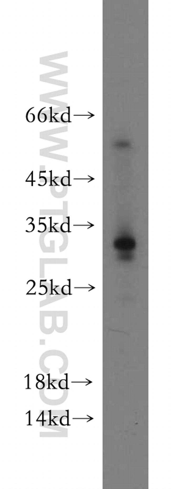 CCDC70 Antibody in Western Blot (WB)