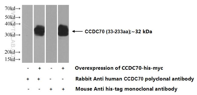 CCDC70 Antibody in Western Blot (WB)