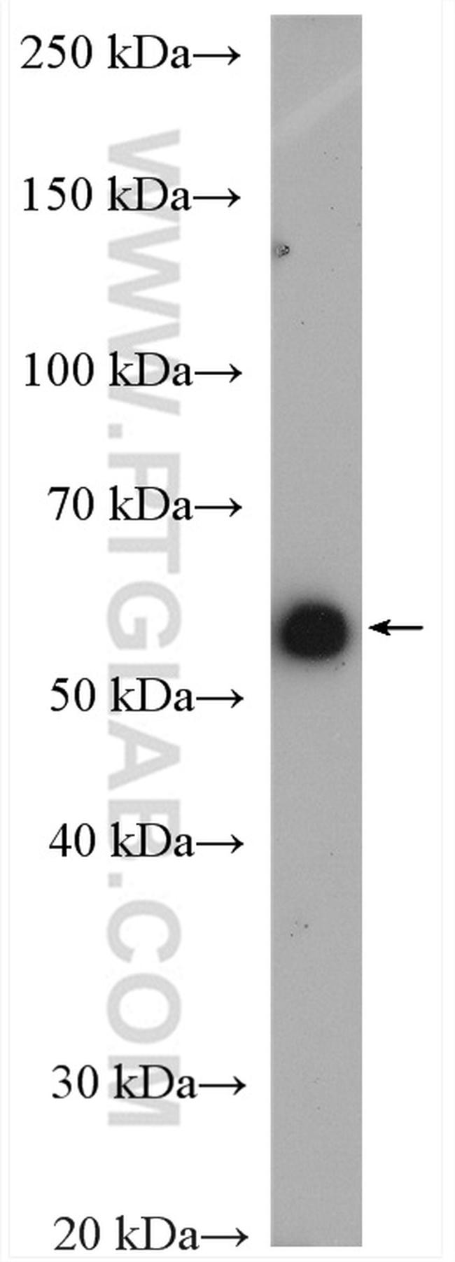 ALDH8A1 Antibody in Western Blot (WB)
