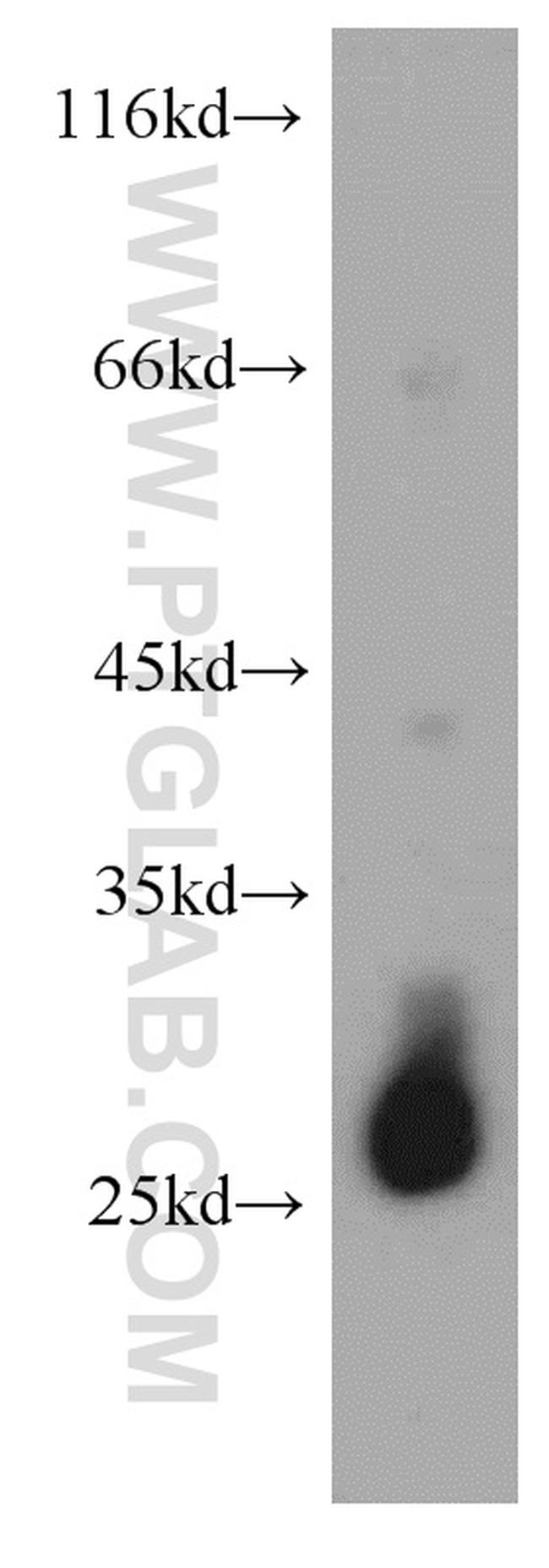 TMED9 Antibody in Western Blot (WB)