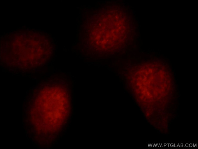 RNF20 Antibody in Immunocytochemistry (ICC/IF)