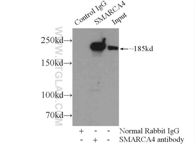 SMARCA4/BRG1 Antibody in Immunoprecipitation (IP)