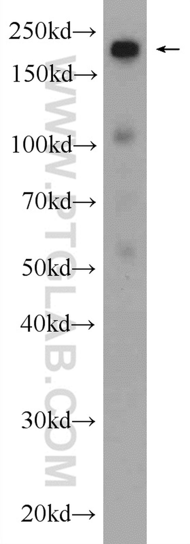 SMARCA4/BRG1 Antibody in Western Blot (WB)