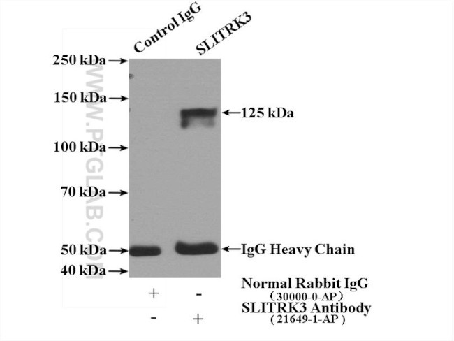 SLITRK3 Antibody in Immunoprecipitation (IP)