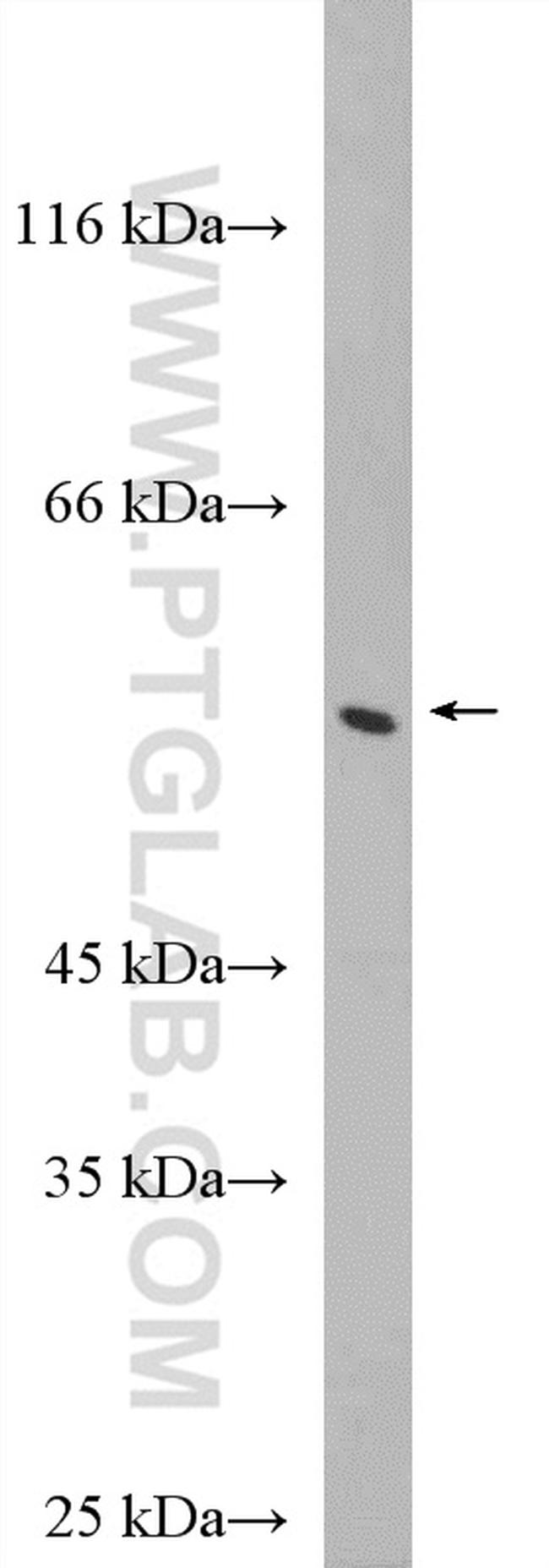 PFKFB1 Antibody in Western Blot (WB)