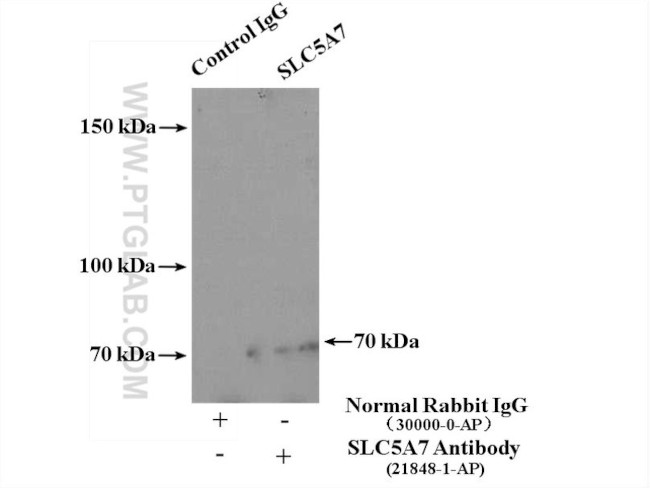 CHT1 Antibody in Immunoprecipitation (IP)