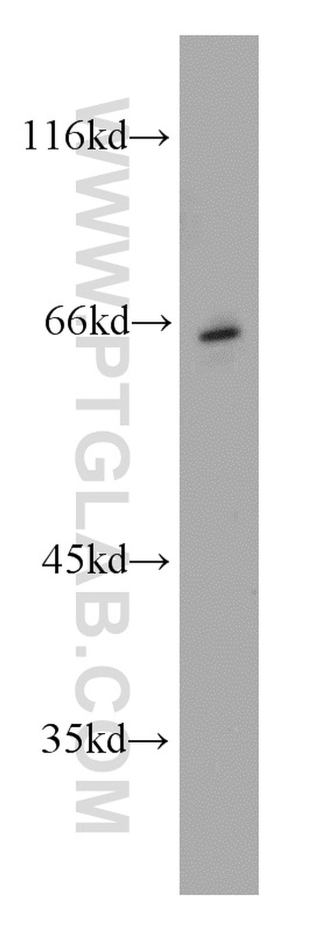 CHT1 Antibody in Western Blot (WB)