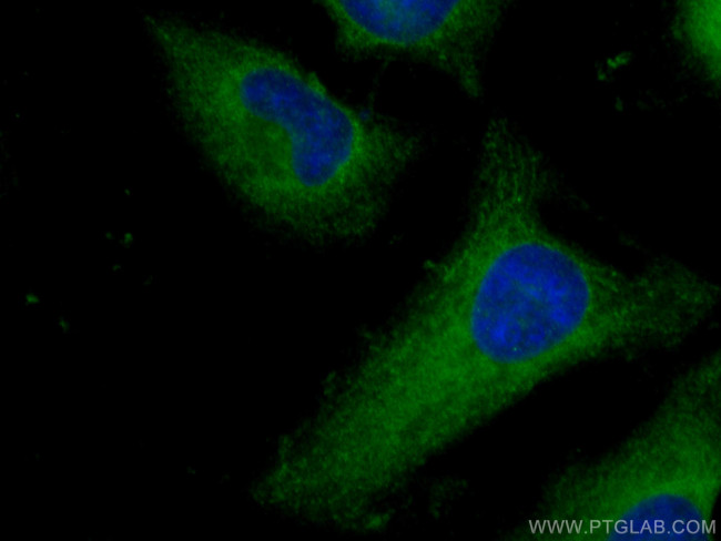 ROCK1 Antibody in Immunocytochemistry (ICC/IF)