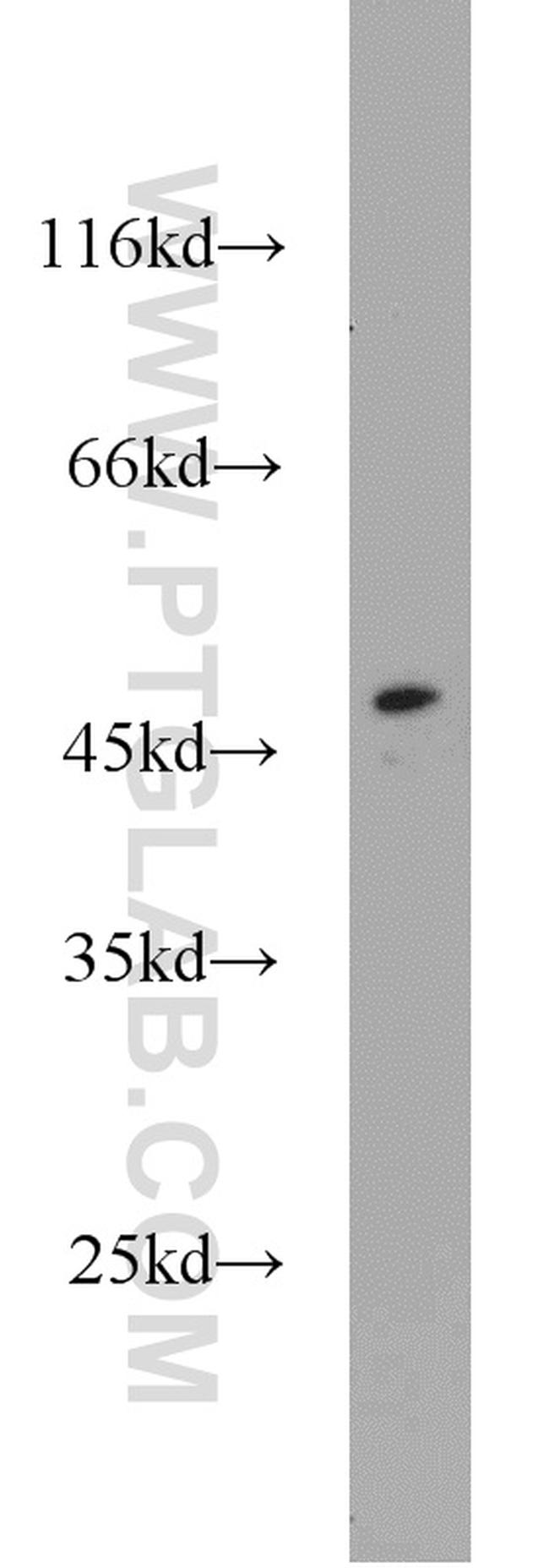 SOAT2 Antibody in Western Blot (WB)
