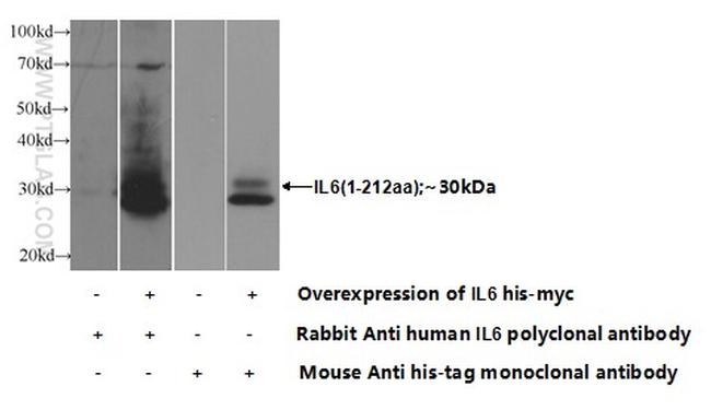 IL-6 Antibody in Western Blot (WB)