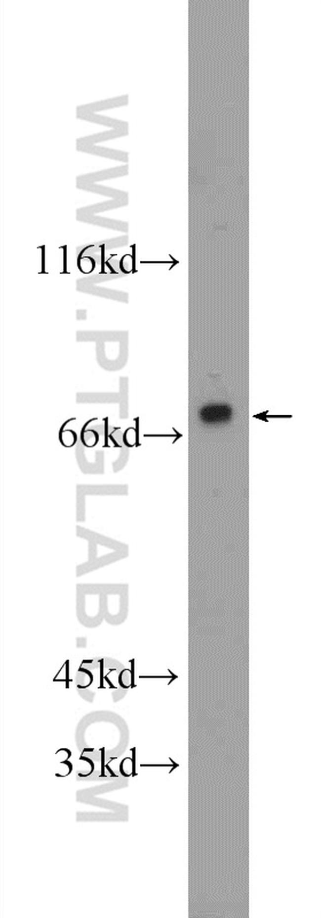 POLD3 Antibody in Western Blot (WB)