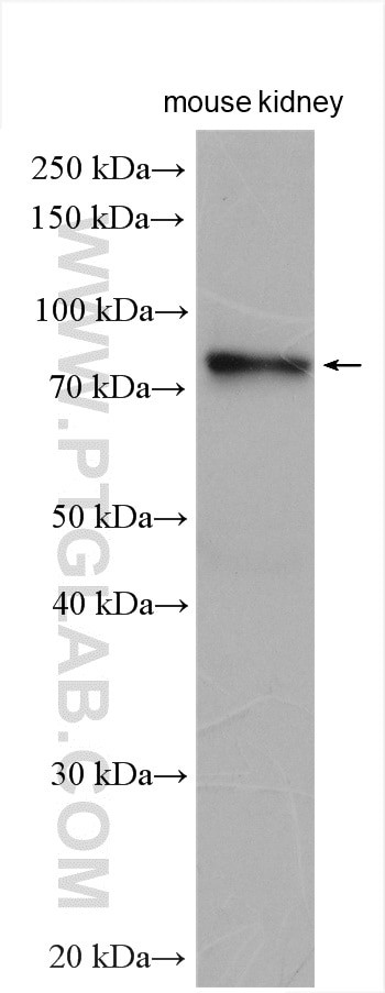 STRA6 Antibody in Western Blot (WB)