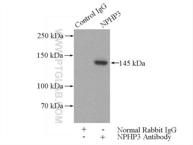 NPHP3 Antibody in Immunoprecipitation (IP)