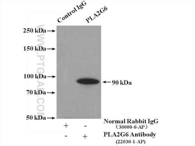 iPLA2 Antibody in Immunoprecipitation (IP)