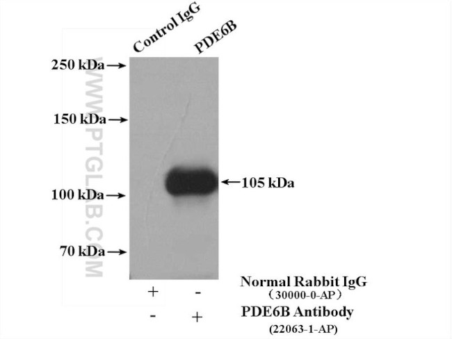 PDE6B Antibody in Immunoprecipitation (IP)