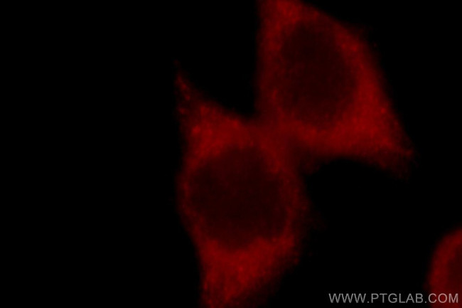 GSK3B Antibody in Immunocytochemistry (ICC/IF)