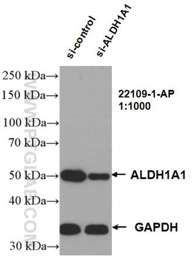 ALDH1A1 Antibody in Western Blot (WB)