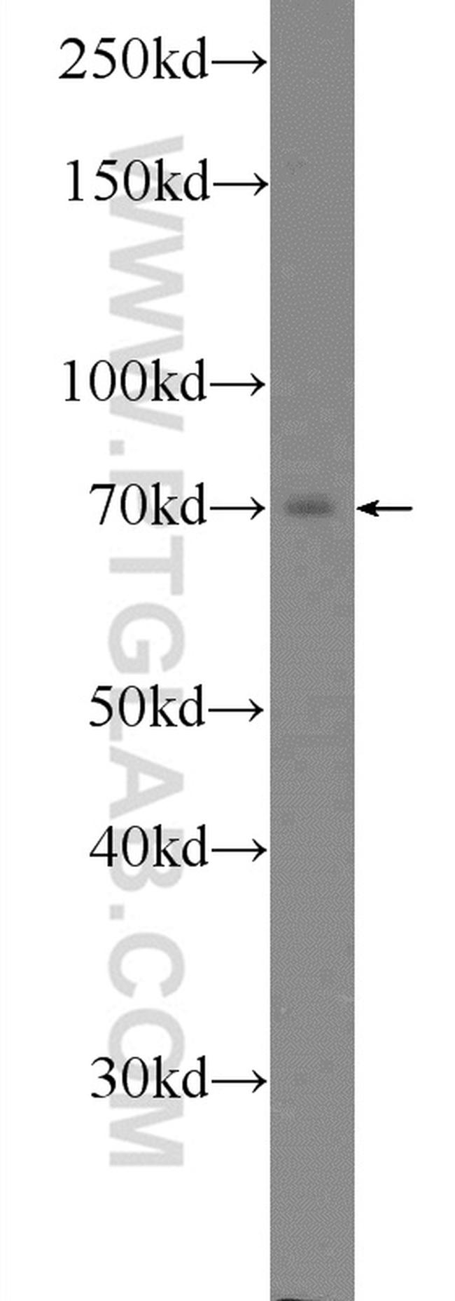 Ubiquilin 1 Antibody in Western Blot (WB)