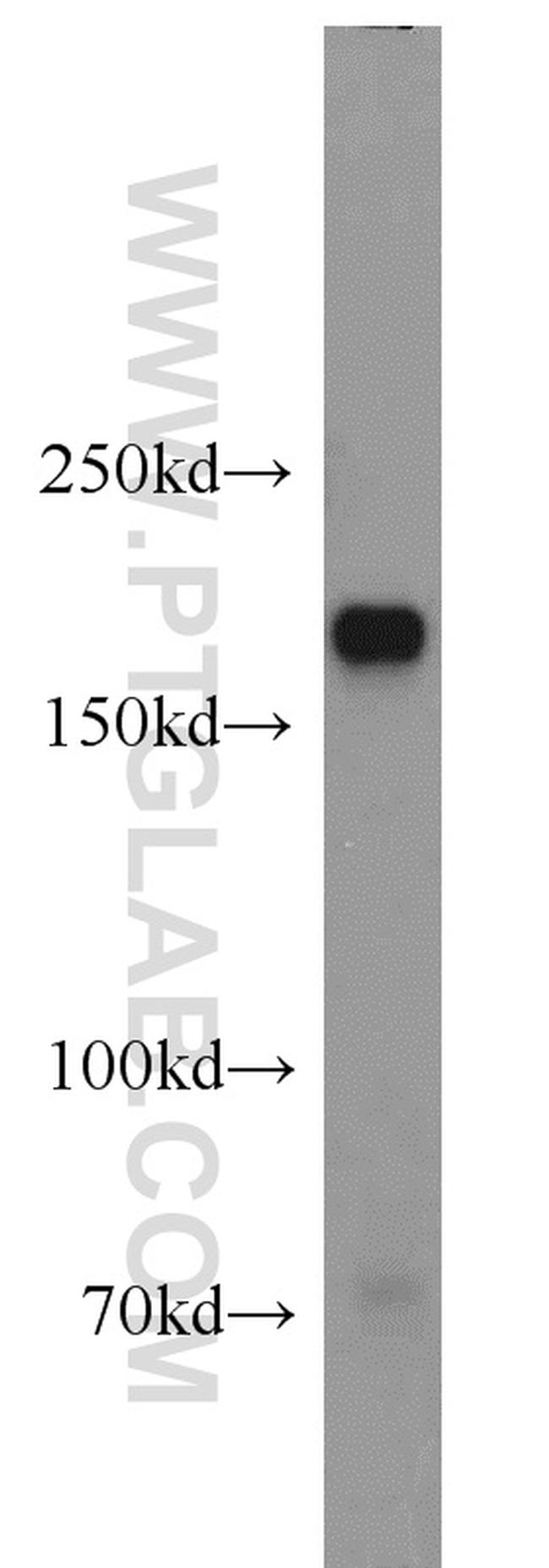 Integrin alpha-1 Antibody in Western Blot (WB)