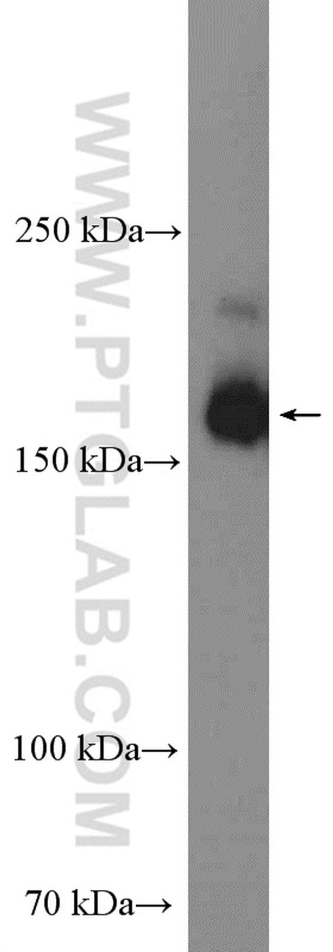 IQGAP1 Antibody in Western Blot (WB)