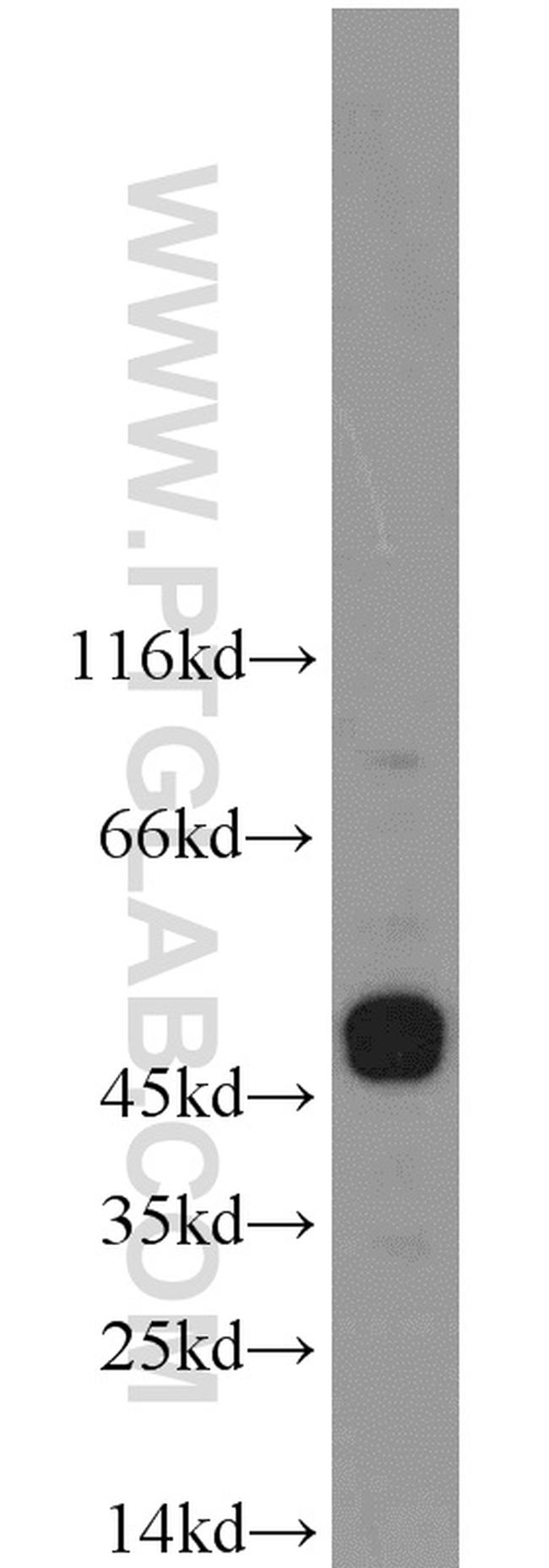 CHRNB4 Antibody in Western Blot (WB)