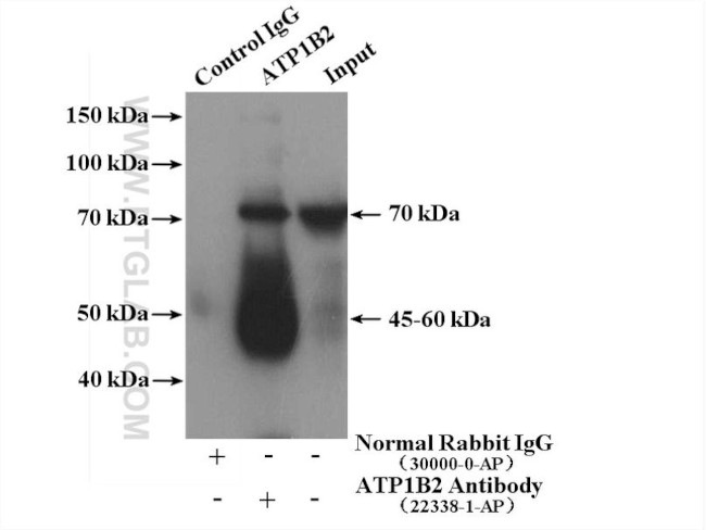 ATP1B2 Antibody in Immunoprecipitation (IP)