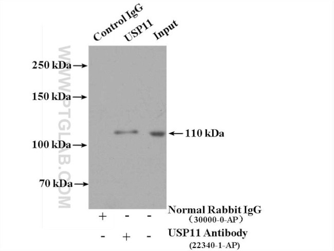 USP11 Antibody in Immunoprecipitation (IP)