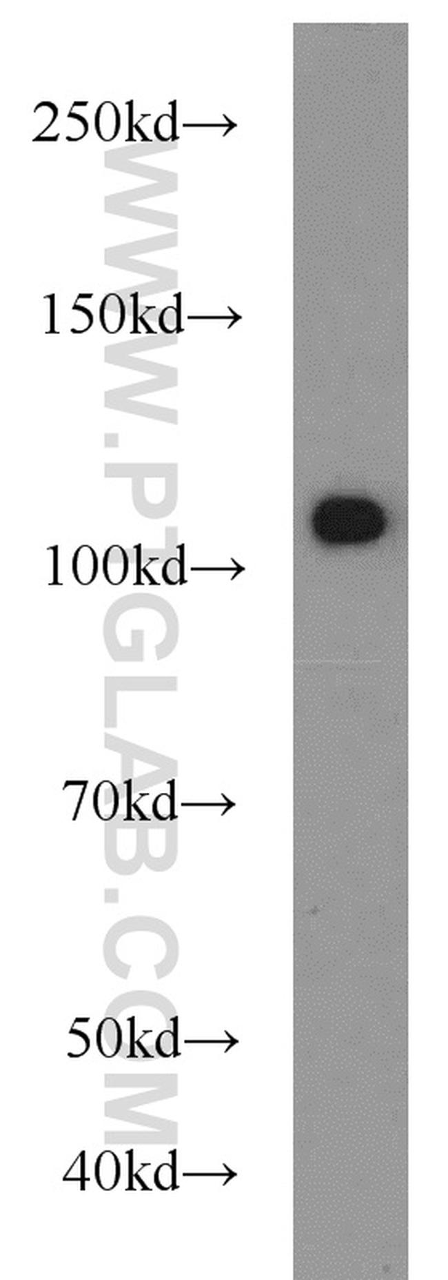 USP11 Antibody in Western Blot (WB)
