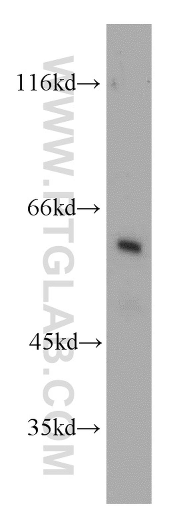 PKLR Antibody in Western Blot (WB)