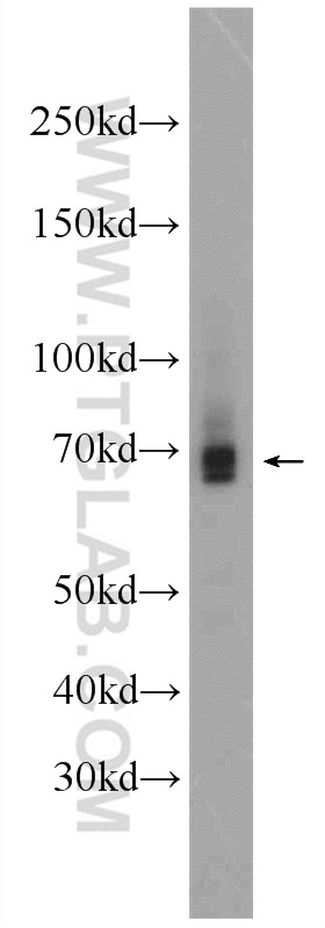AIRE Antibody in Western Blot (WB)