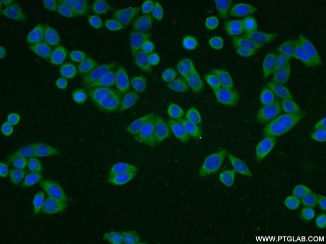 WDR61 Antibody in Immunocytochemistry (ICC/IF)
