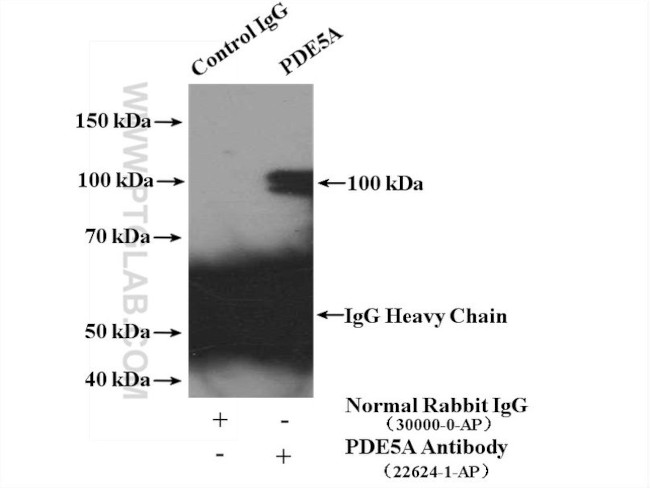 PDE5A Antibody in Immunoprecipitation (IP)
