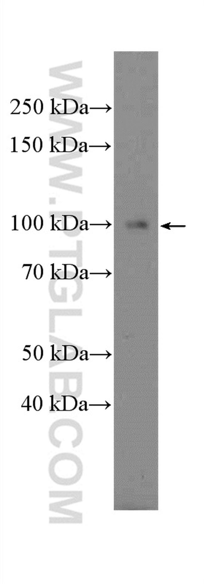 PDE5A Antibody in Western Blot (WB)
