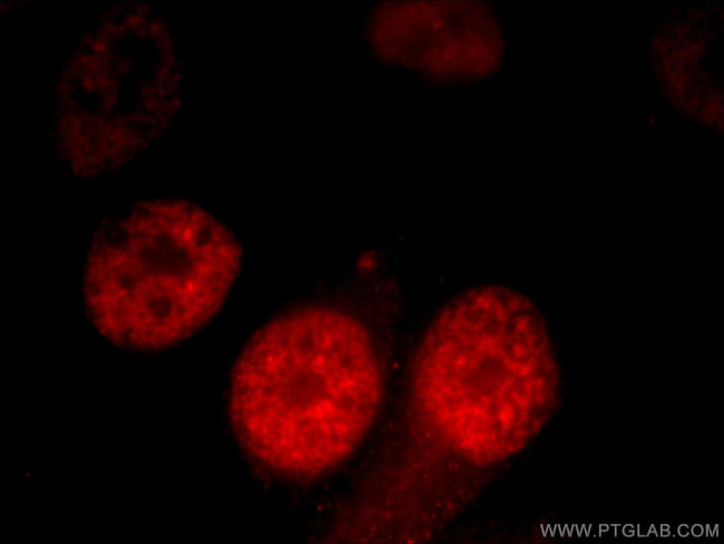 CCAR2 Antibody in Immunocytochemistry (ICC/IF)