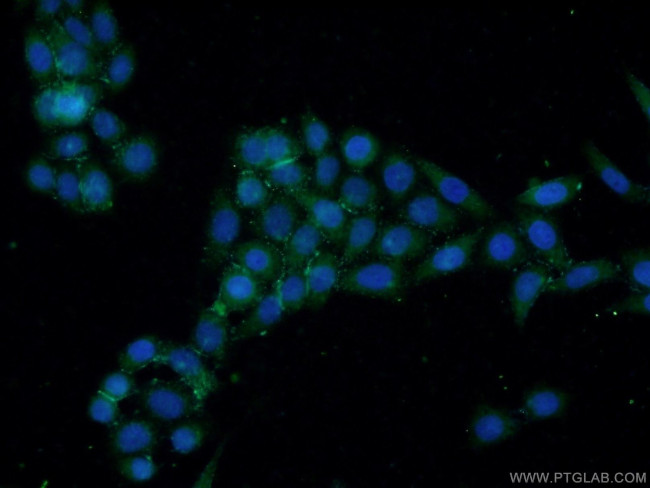 EYA1 Antibody in Immunocytochemistry (ICC/IF)
