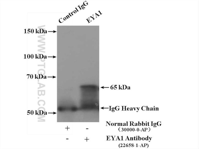 EYA1 Antibody in Immunoprecipitation (IP)