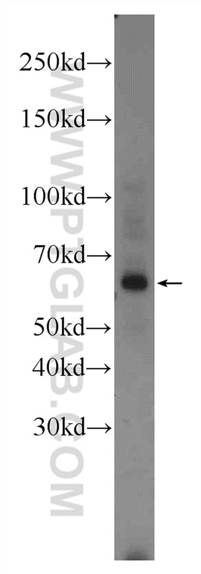 EYA1 Antibody in Western Blot (WB)