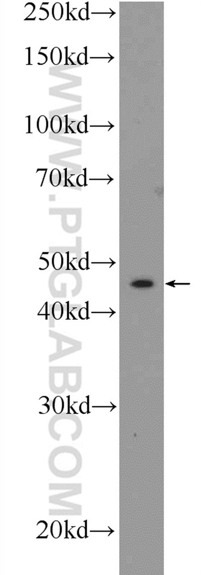 Connexin-46 Antibody in Western Blot (WB)