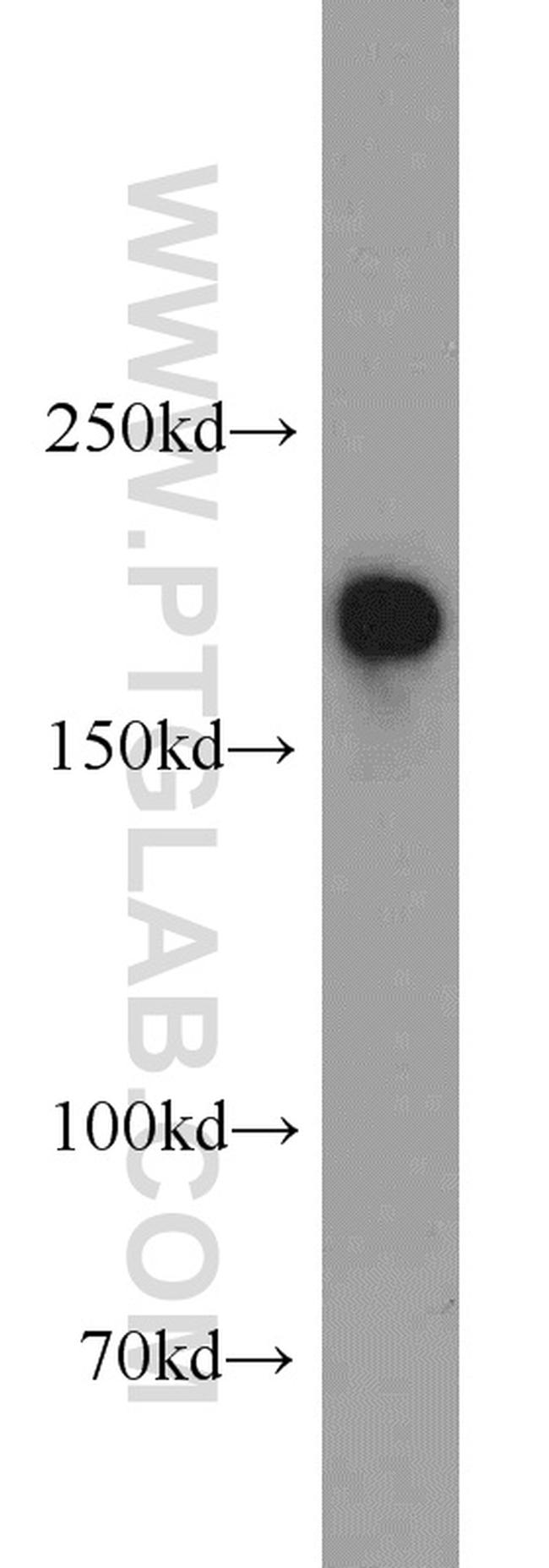 PHLPP Antibody in Western Blot (WB)