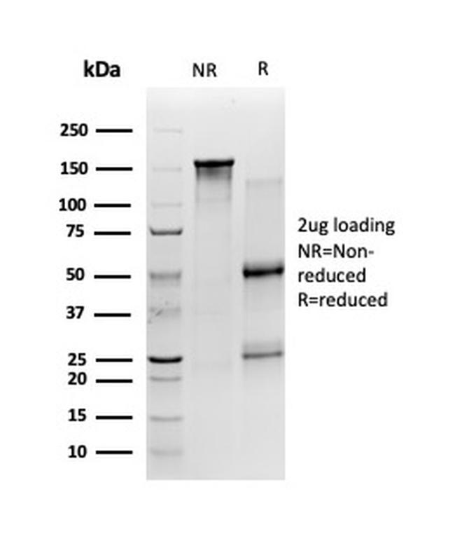 SIRT2 Antibody in SDS-PAGE (SDS-PAGE)