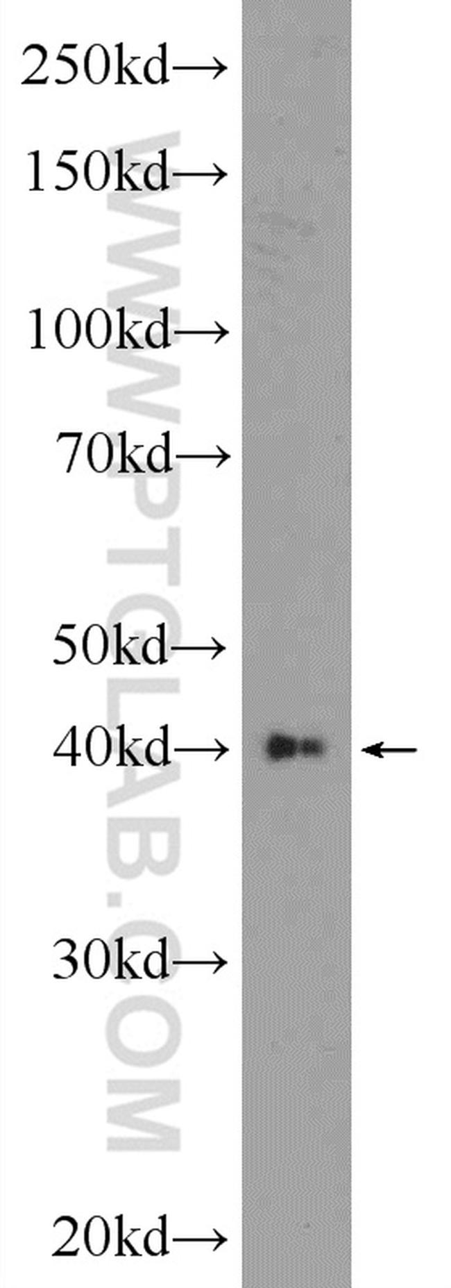 AKD1 Antibody in Western Blot (WB)