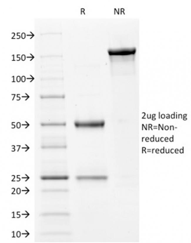Filaggrin Antibody in SDS-PAGE (SDS-PAGE)