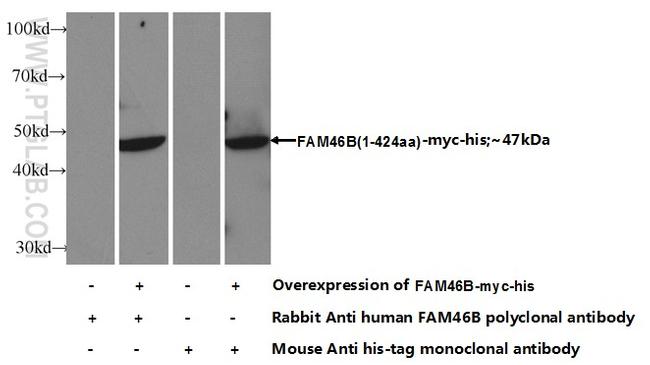 FAM46B Antibody in Western Blot (WB)