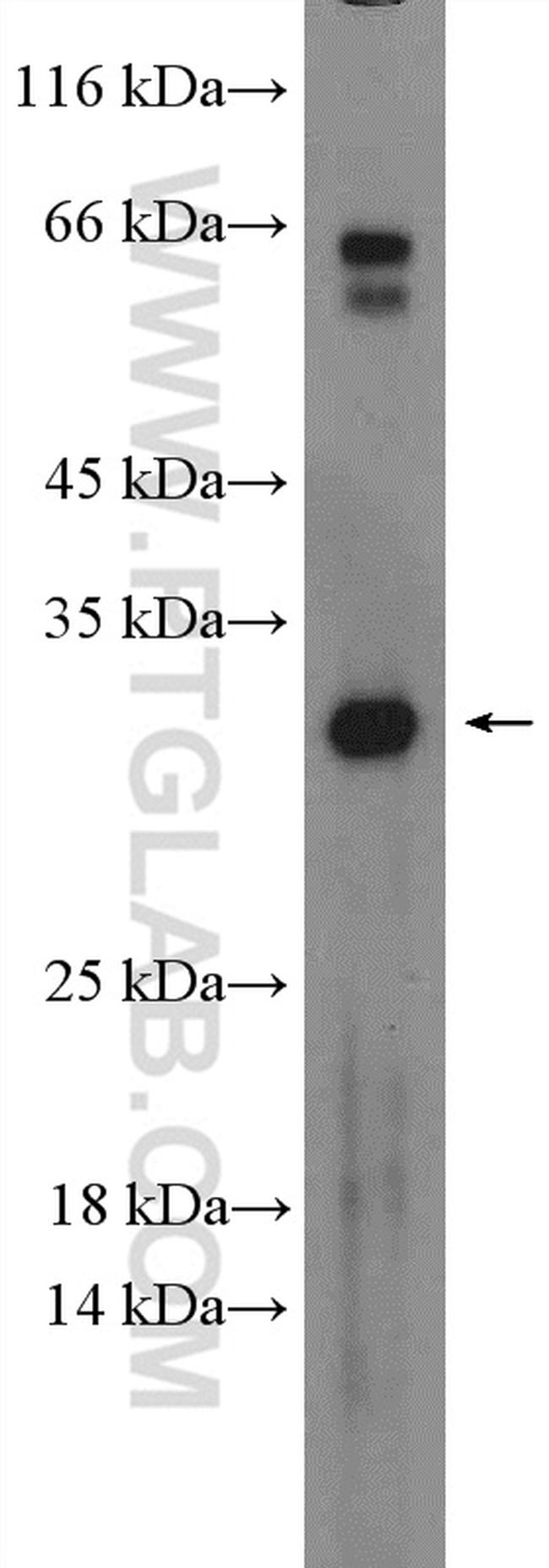 DLX6 Antibody in Western Blot (WB)